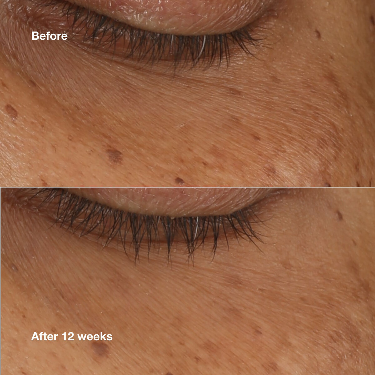 V2HA62B00E4A501E038C6A46B7170C637D4R6436466P2