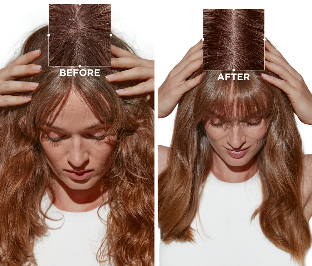 Après shampoing nutritif Kerastase K Symbio 200 ml cuir chevelu sensible